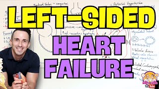 Left Sided Heart Failure