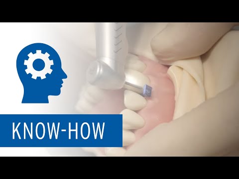 Zolid Preparation Dent Kit – Preparation of anterior teeth