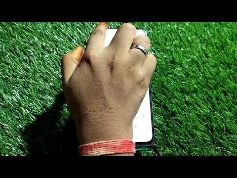 show contactHow To Set Photo In Contact In Xiaomi 12 Lite, Xiaomi 12 Lite,Me Cont