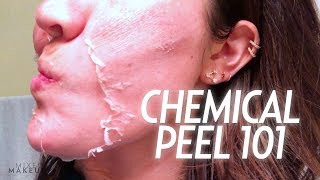 My Chemical Peel After Care Tips + Product Must-Haves! | Beauty with Susan Yara