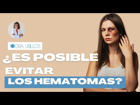 ¿ES POSIBLE EVITAR LOS HEMATOMAS?