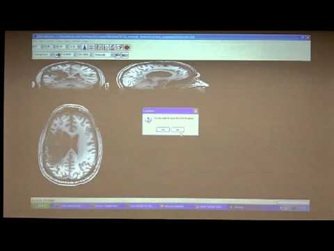 VLSM Mini course (Session 2) 5 of 7