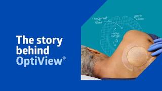 Designed with nurses in mind: The story behind OptiView®