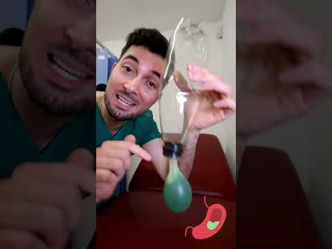 Cancer Symptoms and Signs In Men or Women Shorts