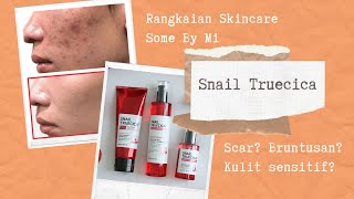 Download lagu Rangkaian Some By Mi Snail Truecica mp3 Download lagu Rangkaian Some By Mi Snail Truecica mp3