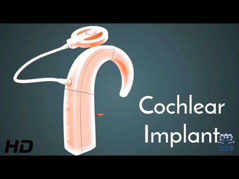 Meniere s disease Everything You Need to Know