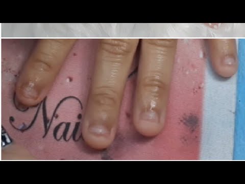 Como aplicar uñas postizas en uñas mordidas ( onicofagia)