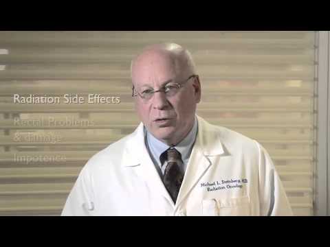 Radiation Therapy Side Effects for Prostate Cancer Patients | Michael Steinberg, MD