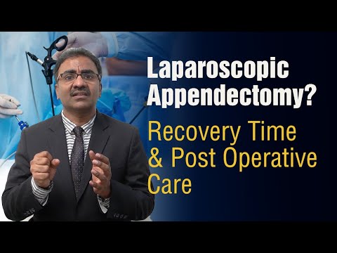 What To Expect After Laparoscopic Appendectomy? Recovery Time & Post Operation Care
