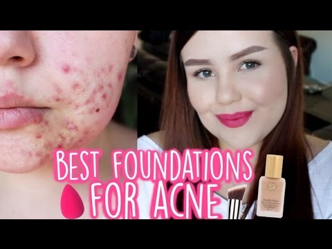 BEST FOUNDATIONS FOR ACNE | My Top 5 Favourite Foundations Video