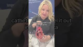 Impella Device | How Impella works for heart failure | Impella demo