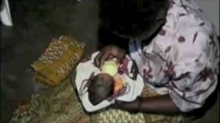 EVERY ONE: Kangaroo Mother Care