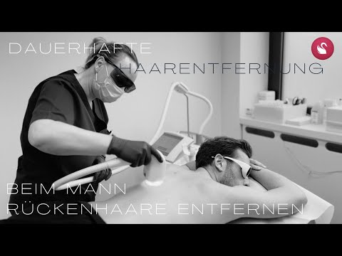 Dauerhafte Haarentfernung beim Mann I Rückenhaare dauerhaft entfernen mittels Laser