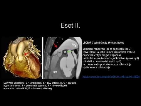 Prosztatagyulladás - Urológiai Központ