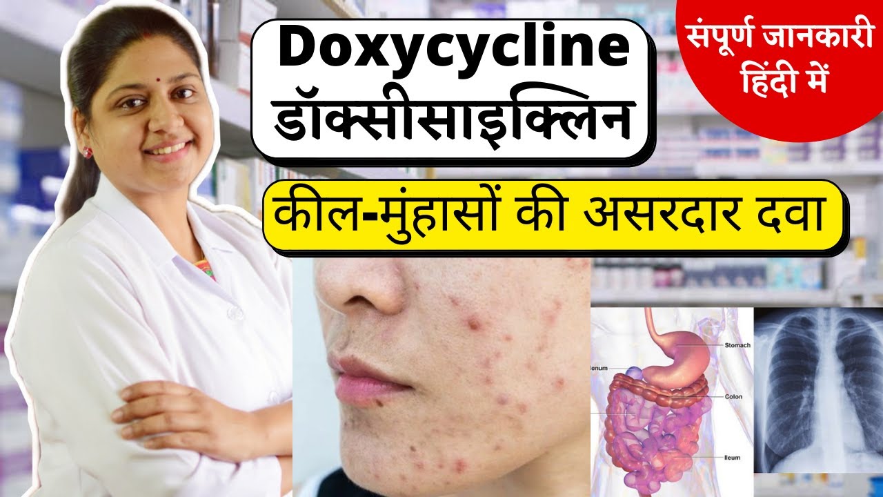 Doxycycline - कील मुहांसे हटाने की असरदार दवा - Doxycycline capsules ip 100mg in Hindi