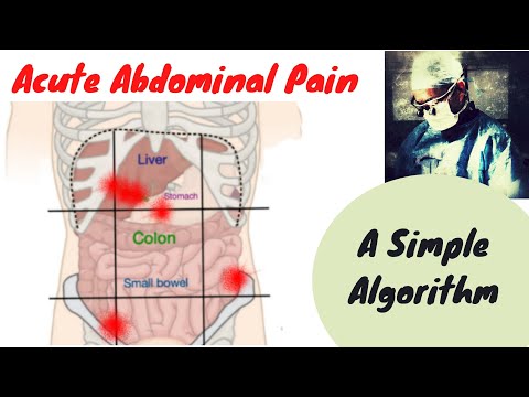 ACUTE ABDOMEN ASSESSMENT IN ER; SUPER QUICK