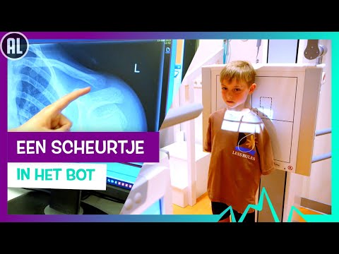 SLEUTELBEEN GEBROKEN 🦴🩺 | TOPDOKS SPOEDEISENDE HULP