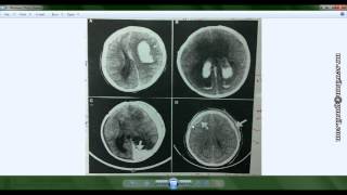 Dr.Mahmoud Sewilam, CT scan, Head