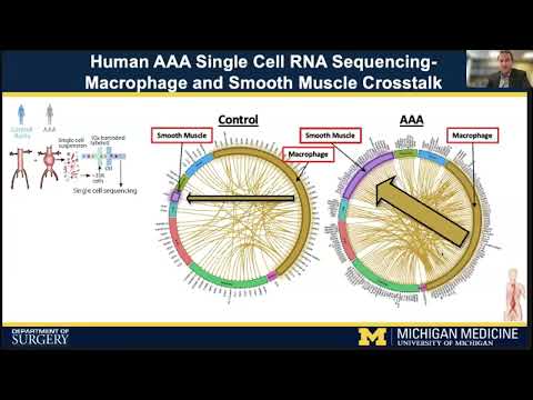 Molecular & cellular dynamics in aortic diseases: New insights - single cell transcriptomic studies