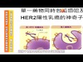 治轉移性乳癌　標靶化療雙效露曙光