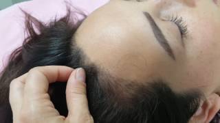 Scalp Microblading - Healed 1st Session