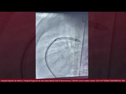 Marcelo Utrera Lagunas-135