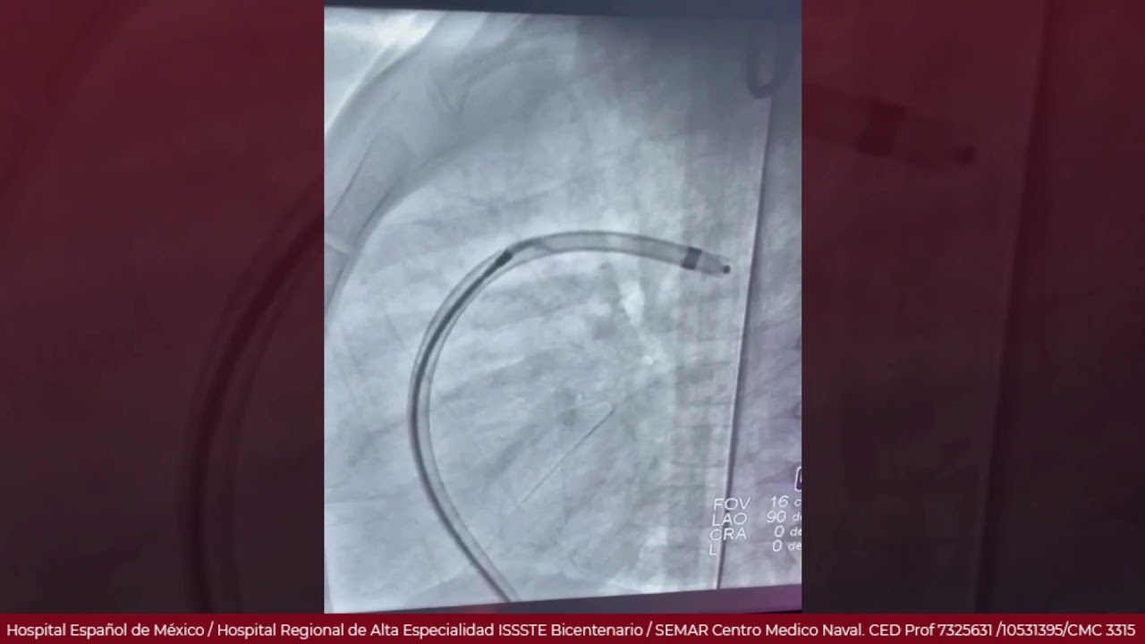 Marcelo Utrera Lagunas-135