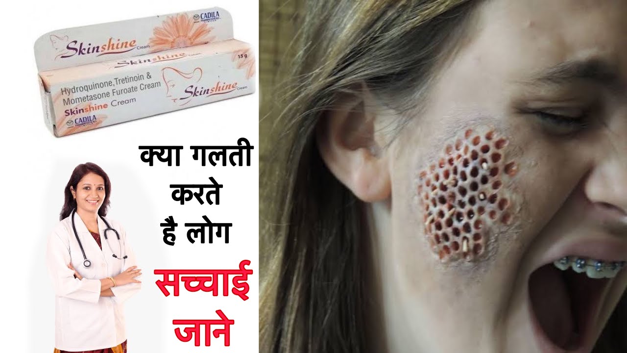 skin shine cream | Side effects | Benefits | how to use | यही सच्चाई किसी ने नहीं बतायी होंगी