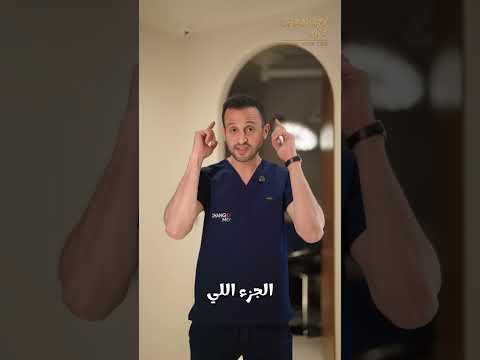 Hair Transplant in Cairo, Egypt by Change Me: Covering Large Bald Areas with Giga Sessions