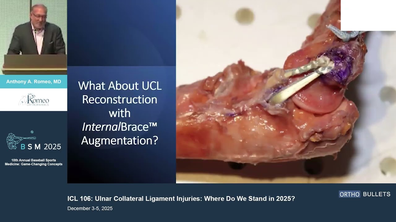 Ulnar Collateral Ligament Injuries_Where Do We Stand In 2025 Anthony A. Romeo MD