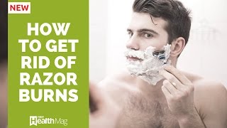 How to Get Rid of Razor Bumps and Burns Naturally