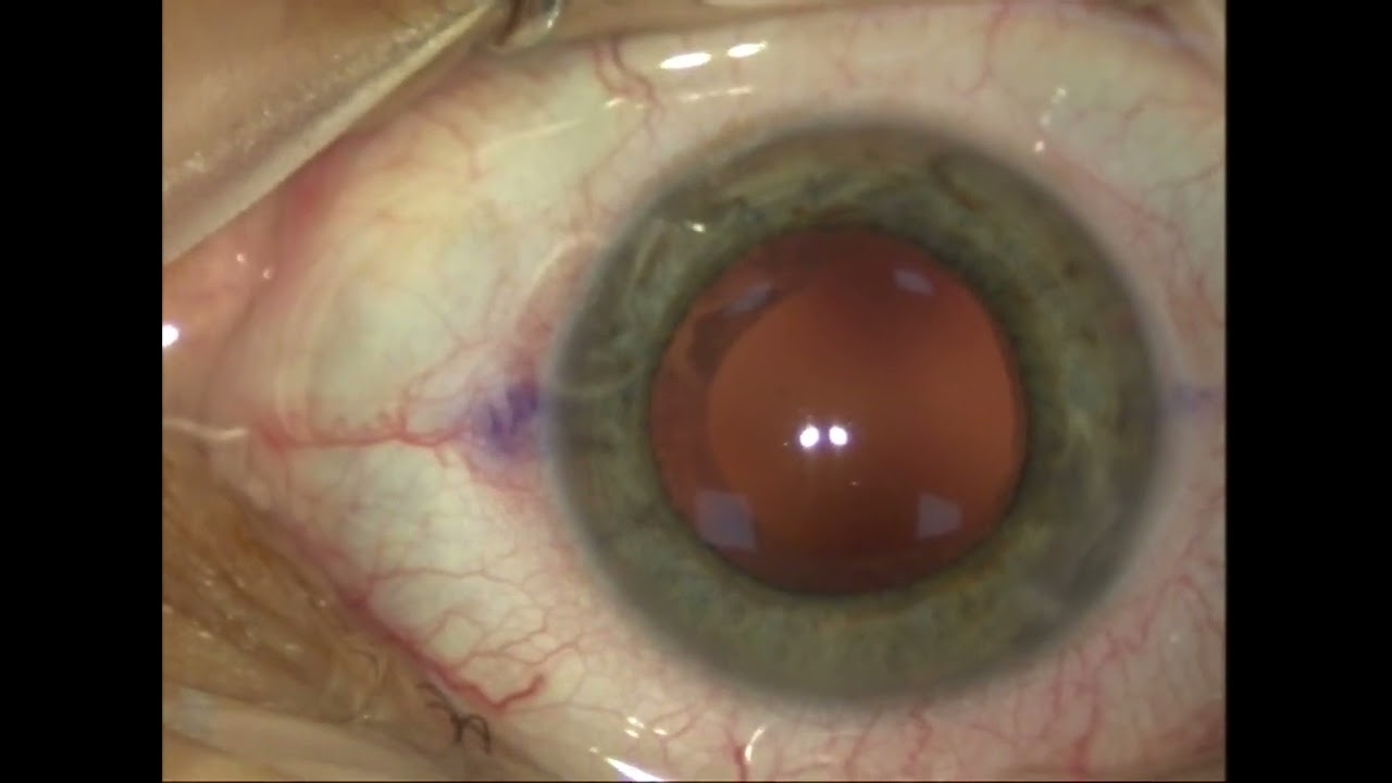 Juan Fernando Rivero Prado-10