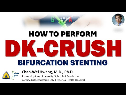 DK Crush: Step by step