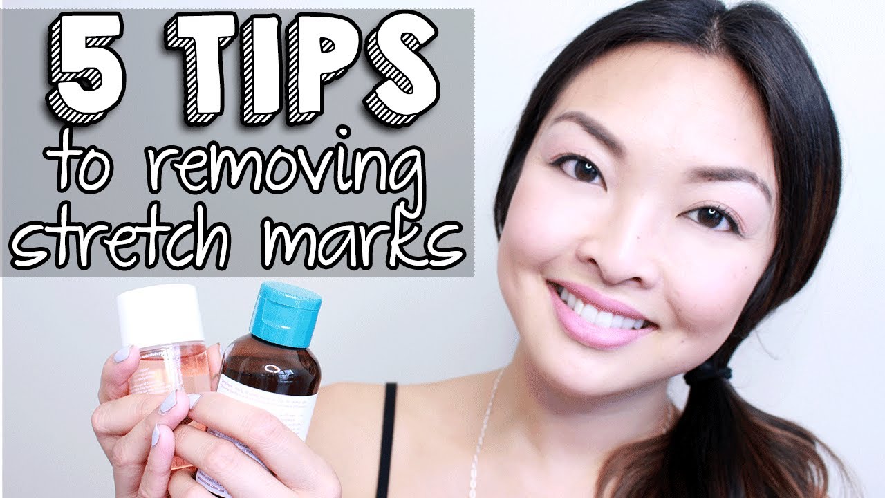 HOW TO: Get Rid Of Stretch Marks INSTANTLY!