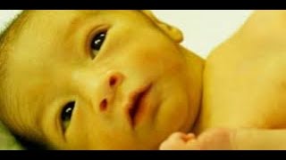 Signs of Pathologic Newborn Jaundice, Neonatal Jaundice, Hyperbilirubinemia Causes, Symptoms