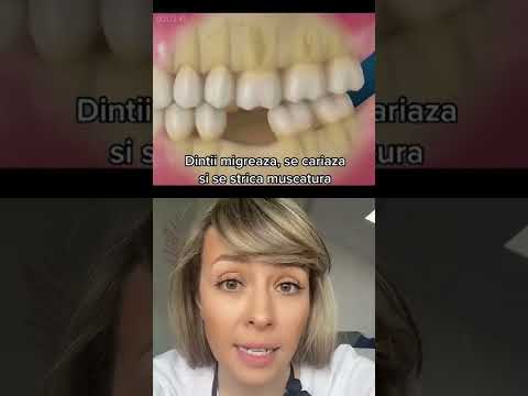 TI-A CAZUT UN DINTE?