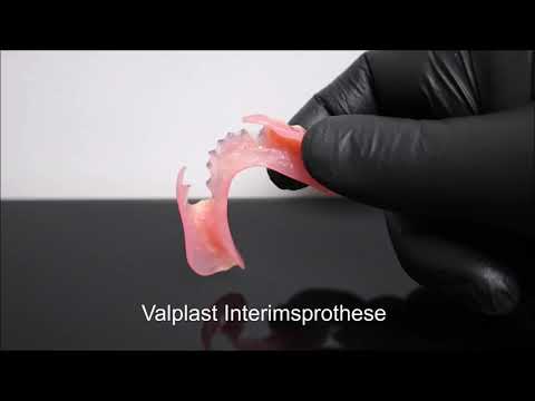 Smart Smile Hannover Valplast Prothese