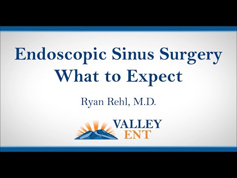 Endoscopic Sinus Surgery What to Expect Ryan Rehl, M D