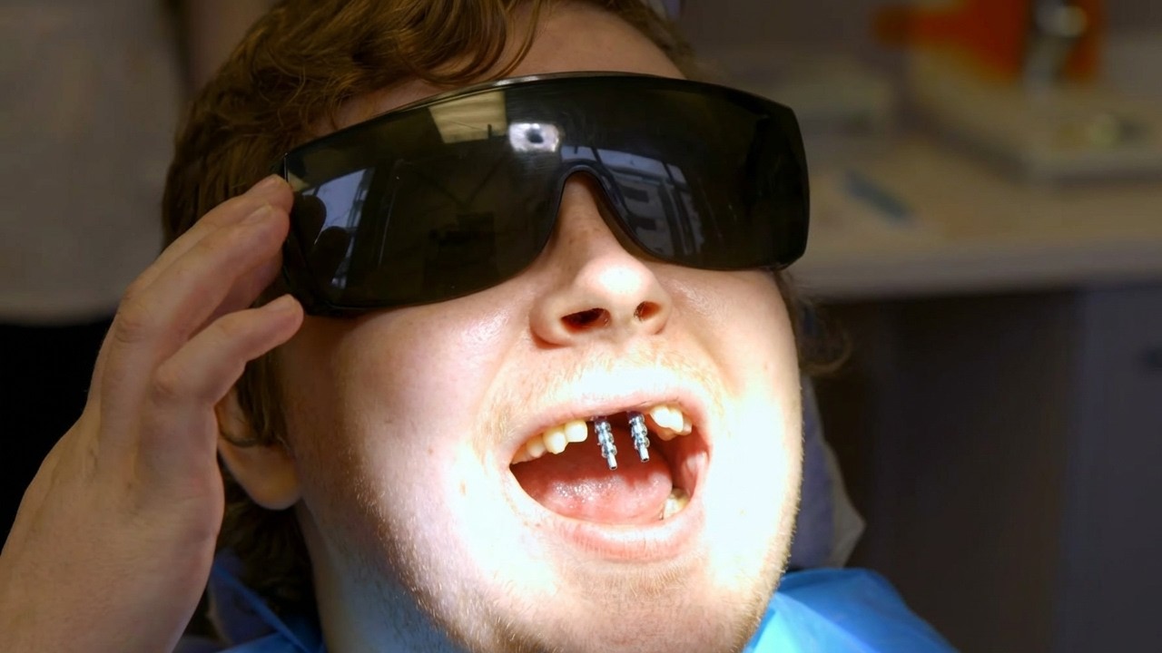 Dentists, the Nation's Biggest Fear: Behind the Scenes of a Dental Hospital