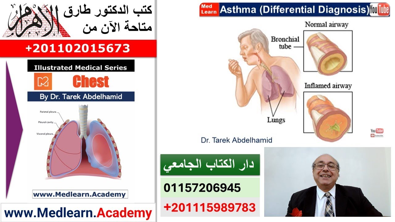 Differential Diagnosis of Asthma  #cme #internal_medicine #medical #usmle #محاضرات_باطنة