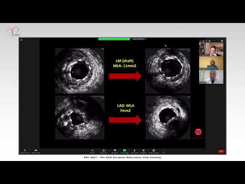 Case presentation and strategy discussion - Dr Luca TESTA