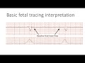 Interpreting Intrapartal fetal heart rate tracings