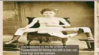 10 Disturbing medical anomalies from History you might not know existed.