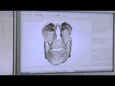 Schmerzmittel für Rückenbehandlung Arthrose des Schultergelenks Physiotherapie