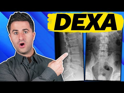 3 facts you MUST KNOW about your DEXA scan
