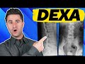 3 things you MUST KNOW about your DEXA scan