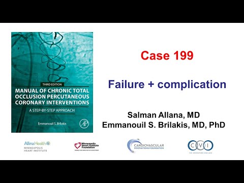 Case 199: Manual of CTO PCI: failure and complication