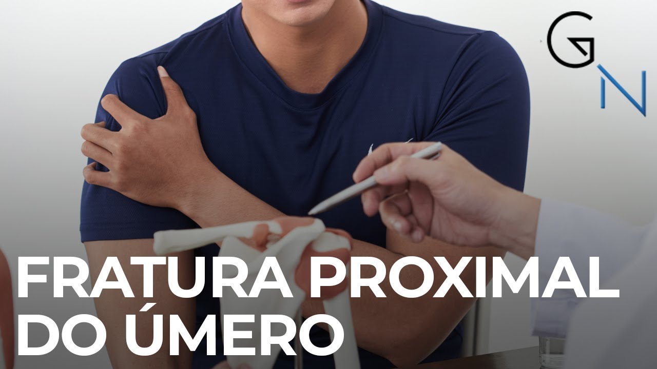OMBRO QUEBRADO? FRATURA DO ÚMERO: Quais os tipos mais frequentes?