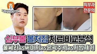 볼살제거 하려면 '볼살지방흡입vs심부볼지방제거' 어떤걸 해야지?