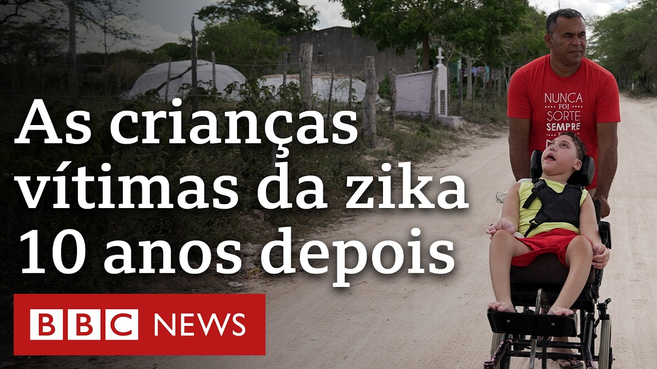Como estão crianças com microcefalia uma década após a epidemia de zika